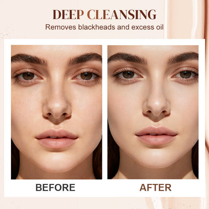 🔥Aloe Vera Blackhead Remover Gel🔥